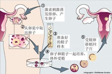 环境